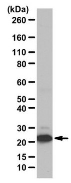 Anti-phospho BAD Antibody (Ser155) from rabbit, purified by affinity chromatography