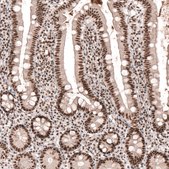 Anti-SETD2 antibody produced in rabbit Prestige Antibodies&#174; Powered by Atlas Antibodies, affinity isolated antibody, buffered aqueous glycerol solution