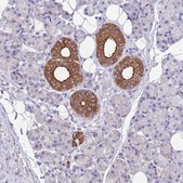 Anti-ATP6V1B1 antibody produced in rabbit Prestige Antibodies&#174; Powered by Atlas Antibodies, affinity isolated antibody, buffered aqueous glycerol solution