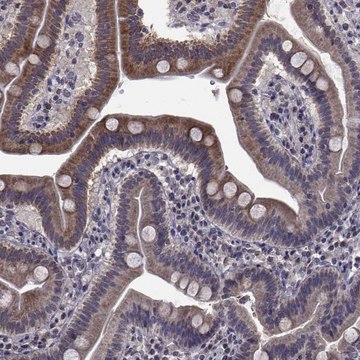Anti-CYP2S1 antibody produced in rabbit Prestige Antibodies&#174; Powered by Atlas Antibodies, affinity isolated antibody