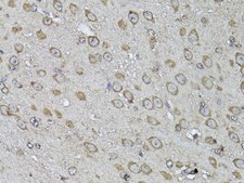Anti-SNAIL antibody produced in rabbit