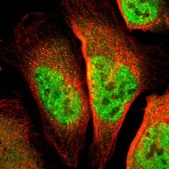 Anti-TSHZ1 antibody produced in rabbit Prestige Antibodies&#174; Powered by Atlas Antibodies, affinity isolated antibody, buffered aqueous glycerol solution