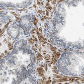 Anti-PANX1 antibody produced in rabbit Prestige Antibodies&#174; Powered by Atlas Antibodies, affinity isolated antibody, buffered aqueous glycerol solution