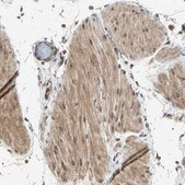 Anti-TRIO antibody produced in rabbit Prestige Antibodies&#174; Powered by Atlas Antibodies, affinity isolated antibody, buffered aqueous glycerol solution