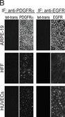 Anti-EGFR Antibody, neutralizing, clone LA1 clone LA1, Upstate&#174;, from mouse