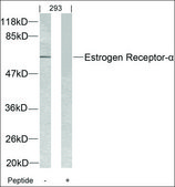 Anti-ESR1 (Ab-104) antibody produced in rabbit affinity isolated antibody