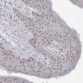 Anti-EXOSC10 antibody produced in rabbit Prestige Antibodies&#174; Powered by Atlas Antibodies, affinity isolated antibody, buffered aqueous glycerol solution, ab1