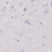 Anti-CSN1S1 antibody produced in rabbit Prestige Antibodies&#174; Powered by Atlas Antibodies, affinity isolated antibody