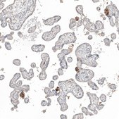 Anti-FN1 antibody produced in rabbit Prestige Antibodies&#174; Powered by Atlas Antibodies, affinity isolated antibody, buffered aqueous glycerol solution