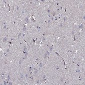 Anti-SHMT1 antibody produced in rabbit Prestige Antibodies&#174; Powered by Atlas Antibodies, affinity isolated antibody, buffered aqueous glycerol solution