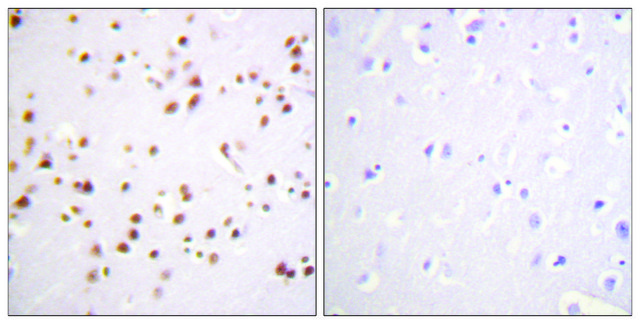 Anti-Catenin-&#948;1 antibody produced in rabbit affinity isolated antibody