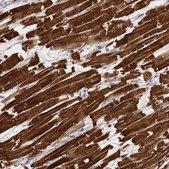 Monoclonal Anti-MYH6 antibody produced in mouse Prestige Antibodies&#174; Powered by Atlas Antibodies, clone CL2162, purified immunoglobulin, buffered aqueous glycerol solution