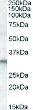 Anti-FHL2 antibody produced in goat affinity isolated antibody, buffered aqueous solution