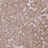 Anti-PC antibody produced in rabbit Prestige Antibodies&#174; Powered by Atlas Antibodies, affinity isolated antibody, buffered aqueous glycerol solution