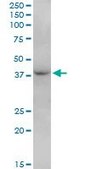 Anti-FBXO28 antibody produced in mouse purified immunoglobulin, buffered aqueous solution