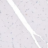 Monoclonal Anti-CDKL5 antibody produced in mouse Prestige Antibodies&#174; Powered by Atlas Antibodies, clone CL4881, purified immunoglobulin, buffered aqueous glycerol solution