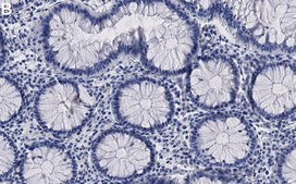 Anti-Phospho-NDRG1 (Thr346) Antibody, clone 5N4 ZooMAb&#174; Rabbit Monoclonal recombinant, expressed in HEK 293 cells