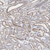 Anti-CTAGE5 antibody produced in rabbit Prestige Antibodies&#174; Powered by Atlas Antibodies, affinity isolated antibody, buffered aqueous glycerol solution