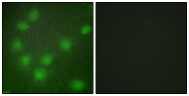Anti-HOXA11 antibody produced in rabbit affinity isolated antibody