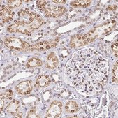 Anti-SYNE2 antibody produced in rabbit Prestige Antibodies&#174; Powered by Atlas Antibodies, affinity isolated antibody, buffered aqueous glycerol solution
