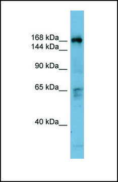 Anti-DOCK2 antibody produced in rabbit affinity isolated antibody