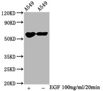 Anti-phospho-PAK1/PAK2/PAK3 (S144+S141+S139) antibody, clone 3H12, Rabbit Monoclonal recombinant, expressed in HEK293F cells