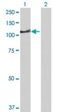 Anti-DIP2A antibody produced in rabbit IgG fraction of antiserum, buffered aqueous solution