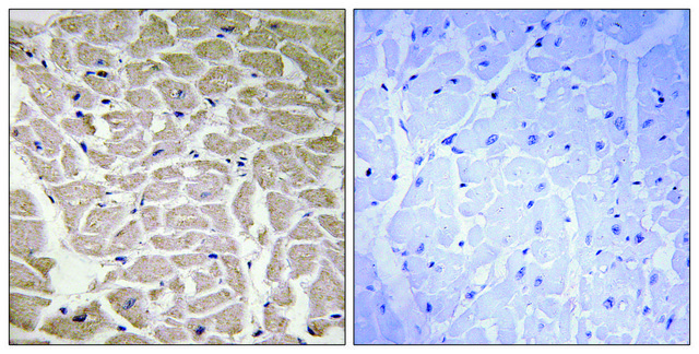 Anti-Collagen XVI &#945;1 antibody produced in rabbit affinity isolated antibody