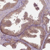 Anti-NT5DC2 antibody produced in rabbit Prestige Antibodies&#174; Powered by Atlas Antibodies, affinity isolated antibody, buffered aqueous glycerol solution