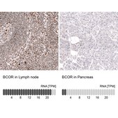 Monoclonal Anti-Bcor Antibody Produced In Mouse Prestige Antibodies&#174; Powered by Atlas Antibodies, clone CL13841, affinity isolated antibody, buffered aqueous glycerol solution