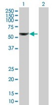 Anti-ALDH6A1 antibody produced in mouse IgG fraction of antiserum, buffered aqueous solution