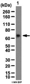 Anti-IGF2 mRNA-binding protein 3 Antibody from rabbit, purified by affinity chromatography