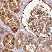 Anti-PSMD1 antibody produced in rabbit Prestige Antibodies&#174; Powered by Atlas Antibodies, affinity isolated antibody, buffered aqueous glycerol solution