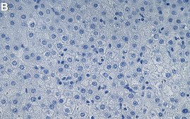 Anti-GRP-78 Antibody, clone 1B11 ZooMAb&#174; Rabbit Monoclonal recombinant, expressed in HEK 293 cells