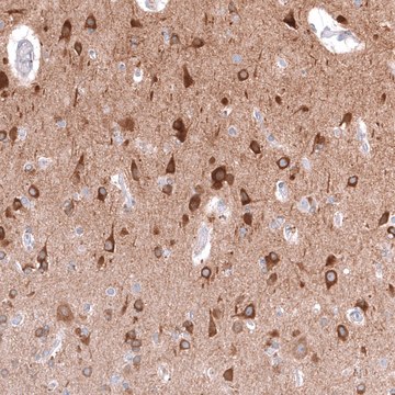 Anti-TTYH3 antibody produced in rabbit Prestige Antibodies&#174; Powered by Atlas Antibodies, affinity isolated antibody, buffered aqueous glycerol solution