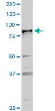 Anti-PLA2G6 antibody produced in rabbit purified immunoglobulin, buffered aqueous solution