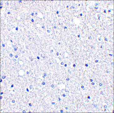 Anti-TIGAR (ab1) antibody produced in rabbit affinity isolated antibody, buffered aqueous solution