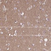 Anti-CRMP1 antibody produced in rabbit Prestige Antibodies&#174; Powered by Atlas Antibodies, affinity isolated antibody, buffered aqueous glycerol solution