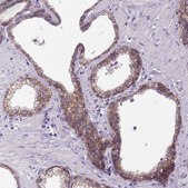 Anti-CDH1 antibody produced in rabbit Prestige Antibodies&#174; Powered by Atlas Antibodies, affinity isolated antibody, buffered aqueous glycerol solution