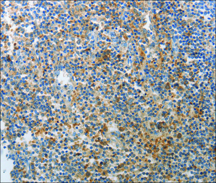 Anti-AD7C-NTP antibody produced in rabbit affinity isolated antibody