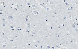 Anti-Renin Receptor Antibody, clone 1C22 ZooMAb&#174; Rabbit Monoclonal recombinant, expressed in HEK 293 cells