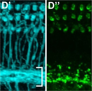 Anti-Choline Acetyltransferase Antibody Chemicon&#174;, from goat