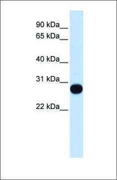 Anti-TCEAL4 antibody produced in rabbit affinity isolated antibody