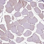 Anti-RAB43 antibody produced in rabbit Prestige Antibodies&#174; Powered by Atlas Antibodies, affinity isolated antibody, buffered aqueous glycerol solution