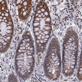 Anti-DDX24 antibody produced in rabbit Prestige Antibodies&#174; Powered by Atlas Antibodies, affinity isolated antibody, buffered aqueous glycerol solution
