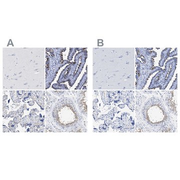 Anti-RSPH1 antibody produced in rabbit Prestige Antibodies&#174; Powered by Atlas Antibodies, affinity isolated antibody, buffered aqueous glycerol solution