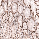 Anti-NUP54 antibody produced in rabbit Prestige Antibodies&#174; Powered by Atlas Antibodies, affinity isolated antibody, buffered aqueous glycerol solution