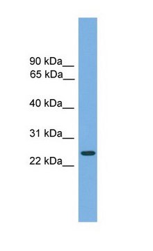 Anti-CHMP4B antibody produced in rabbit affinity isolated antibody