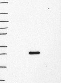 Anti-LMO2 antibody produced in rabbit Prestige Antibodies&#174; Powered by Atlas Antibodies, affinity isolated antibody, buffered aqueous glycerol solution