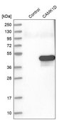 Anti-CAMK1D antibody produced in rabbit Prestige Antibodies&#174; Powered by Atlas Antibodies, affinity isolated antibody, buffered aqueous glycerol solution